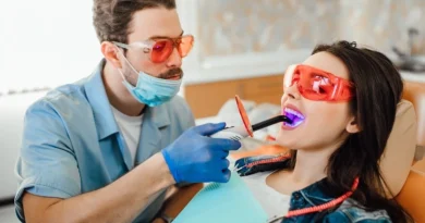 teeth whitening cost in Chennai
